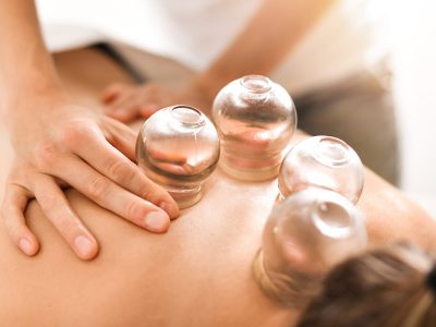 Could_You_Benefit_From_Cupping_Therapy